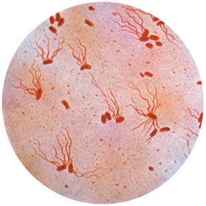 typhoid