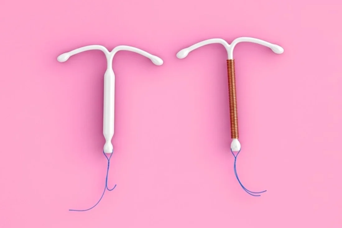 comparaison sterilet cuivre hormonal 2985532d 8474 4f8d 83a1 2cd638e71c4a