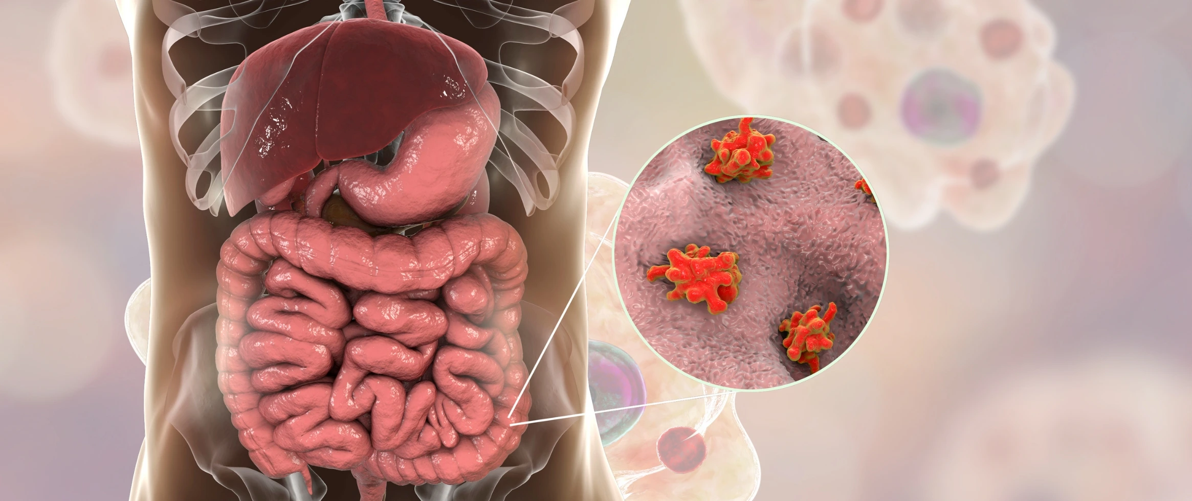 Amebiasis(AmoebicDysentery) Signs,Symptoms&HowIt’sTreated29092501322172